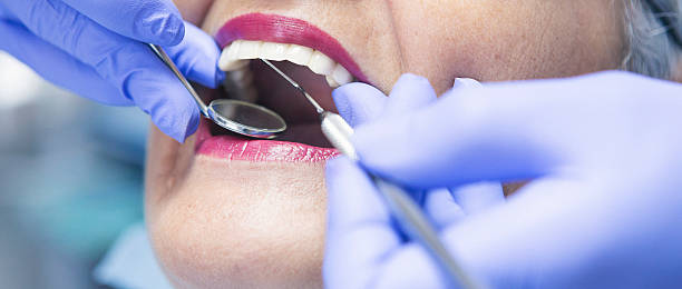 Best Knocked-Out Tooth (Avulsed Tooth) Treatment in Locust Grove, OK